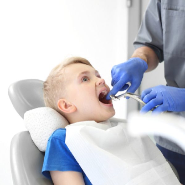 Tooth,Extraction,,Dental,Office.child,At,The,Dentist.,A,Child,In