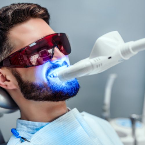 Close,Up,View,Of,Man,Undergoing,Laser,Tooth,Whitening,Treatment
